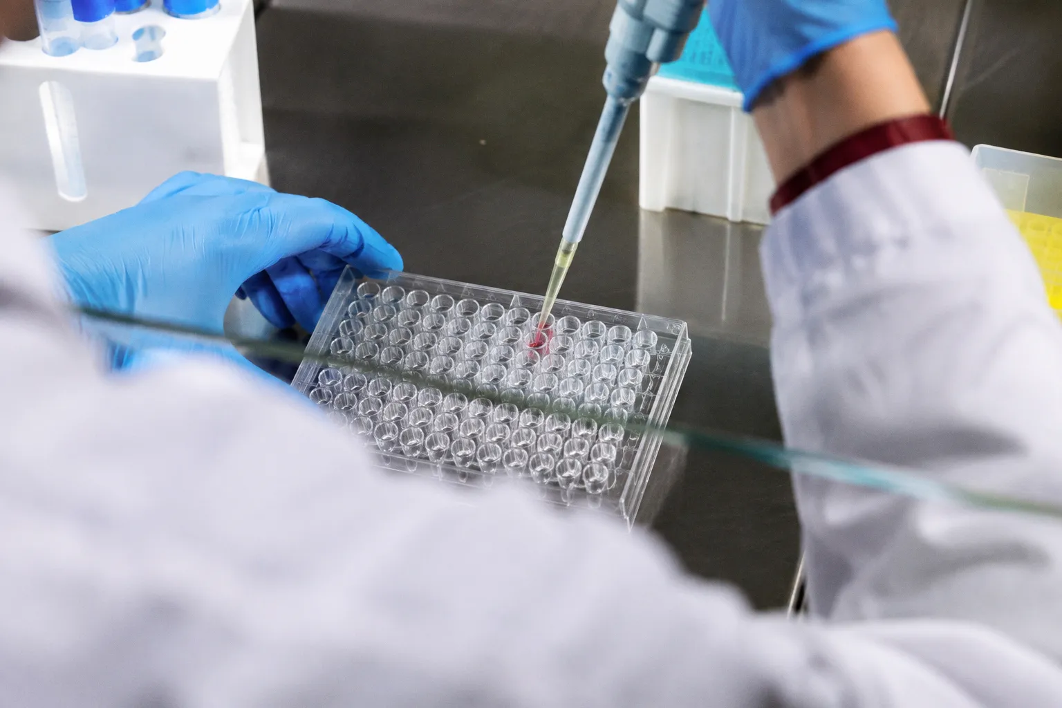 Multiplex-PCR: Wann ist das Kombi-Panel sinnvoll?